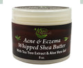 Acne & Eczema Whipped Shea Butter